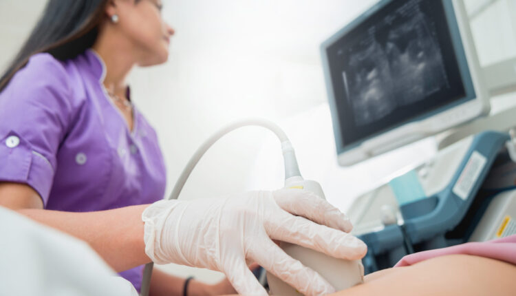 Ultrasound,Scanner,In,The,Hands,Of,A,Doctor.,Diagnostics.,Sonography.