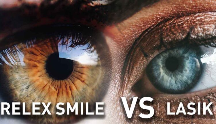 Lasik and Smile