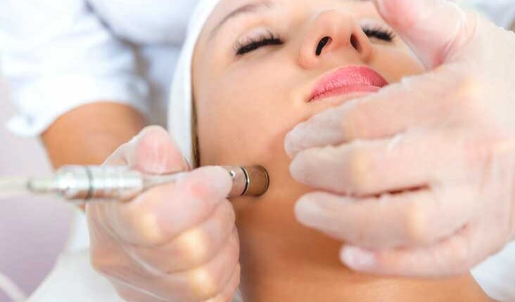 Microdermabrasion for Your Skin